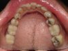 Dental Esthetics of Boca Raton PA