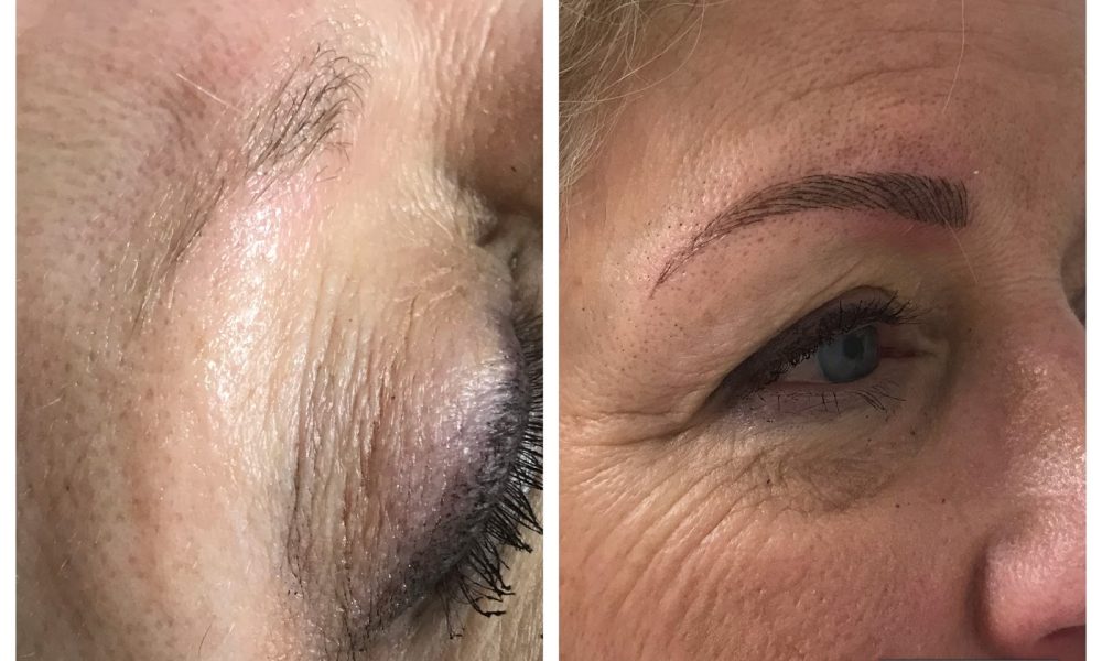 Boca Raton Microblading And Laser Hair removal