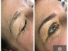 Boca Raton Microblading And Laser Hair removal