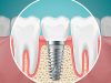 Best Choice Dental - Boca Raton