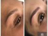 Boca Raton Microblading And Laser Hair removal