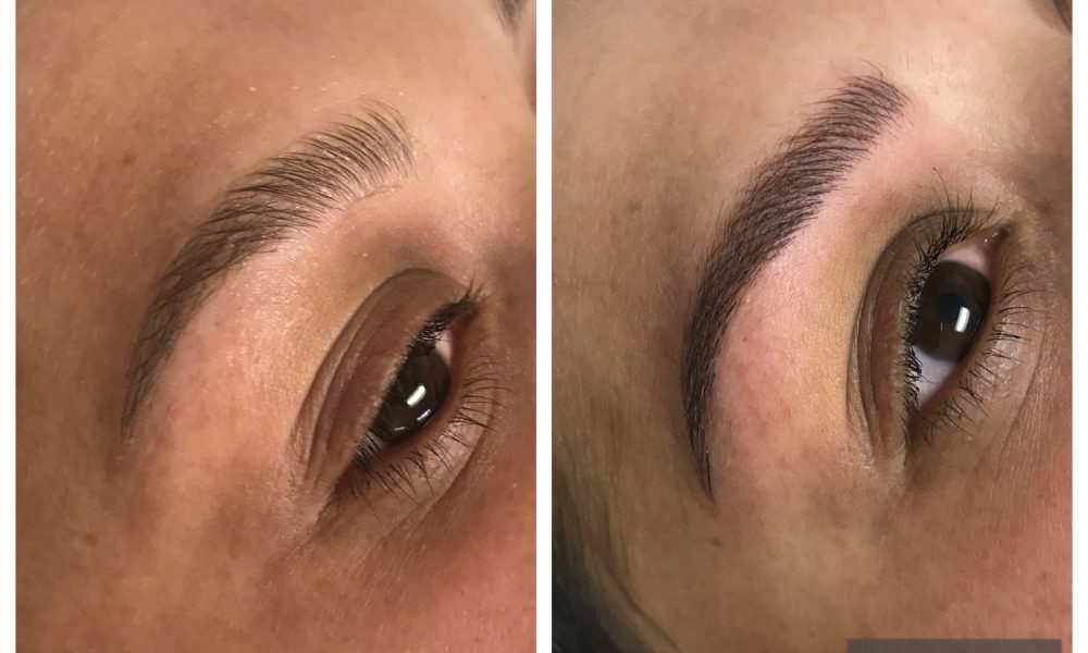 Boca Raton Microblading And Laser Hair removal