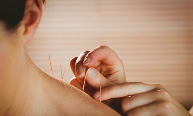 Eduardo Aversano Acupuncture