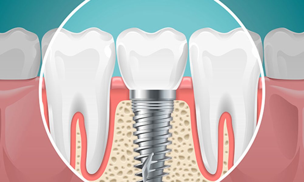 Best Choice Dental - Boca Raton