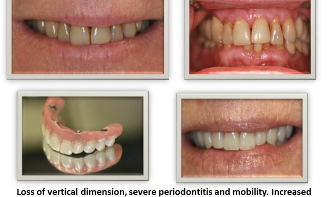 Florida Dental Rejuvenation