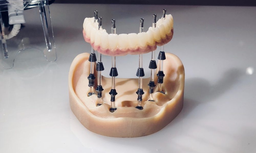 Boca Dentist