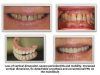 Florida Dental Rejuvenation