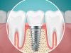Best Choice Dental - Boca Raton