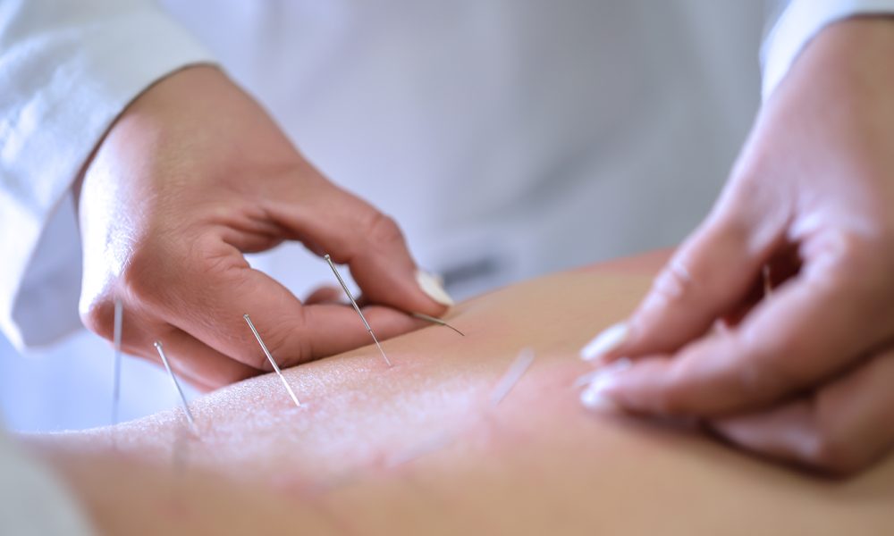 LEAF Integrative Acupuncture