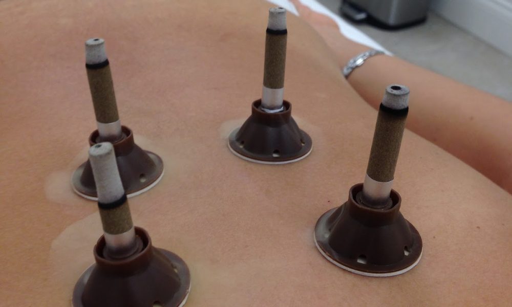 Derun Clinic Acupuncture & Herb Supplement