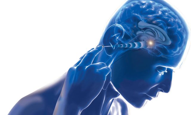 The Sadkhin Complex of Boca Raton