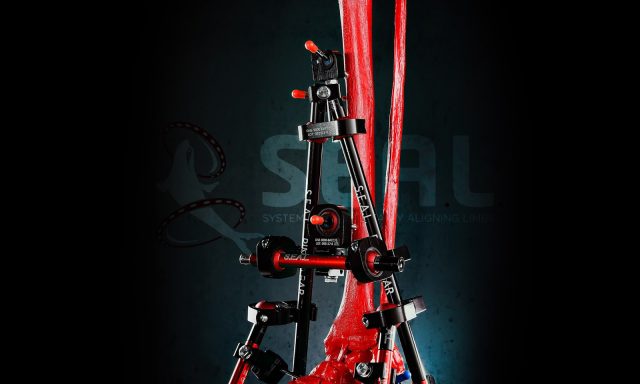 DNE SEAL External Fixation