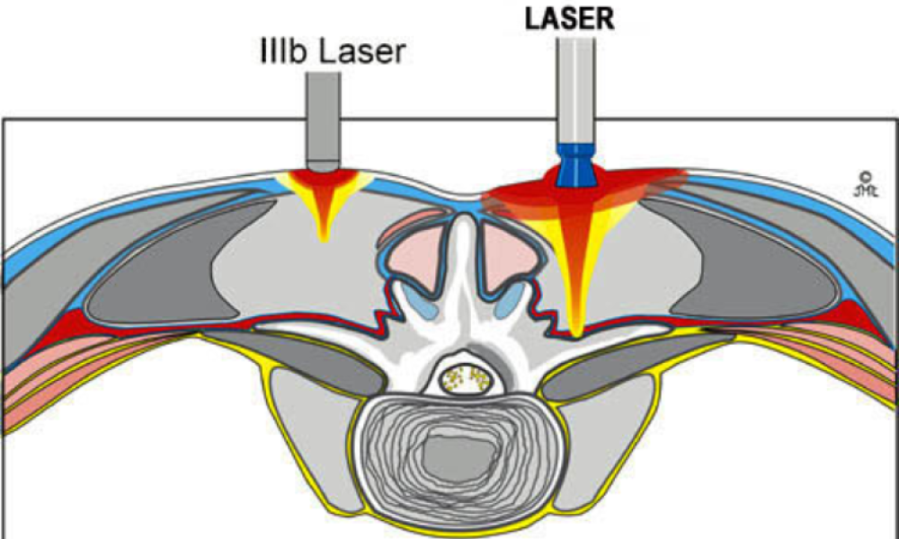 Vitality Spine & Wellness